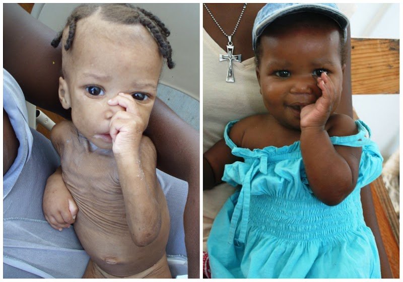 Training & Equipment for Nutrition Workers: Haiti