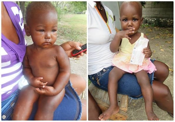 Training & Equipment for Nutrition Workers: Haiti