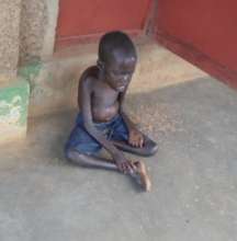 Child with Nodding Syndrome