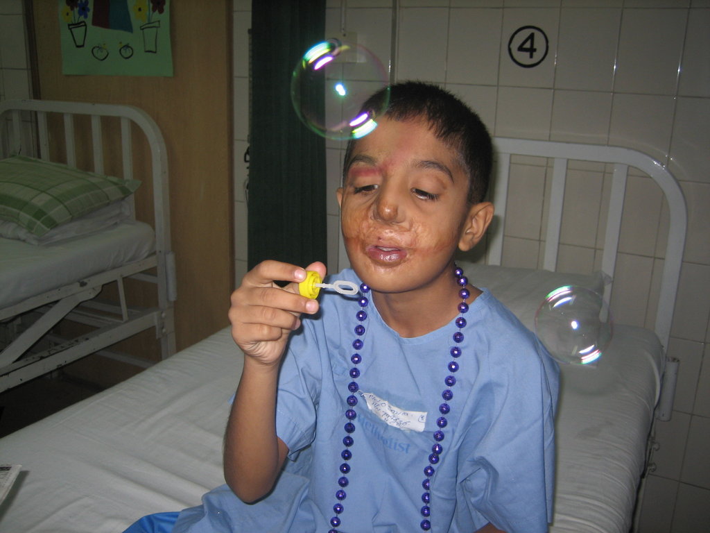 Medical Treatment for 100 Burn Children