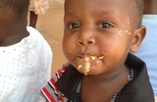 Daily Bread Farm for malnourished children - Benin