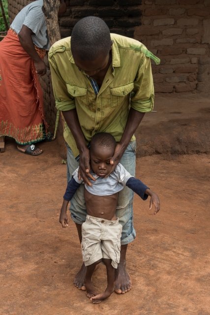 Protect 500 Kids with Disabilities in Malawi