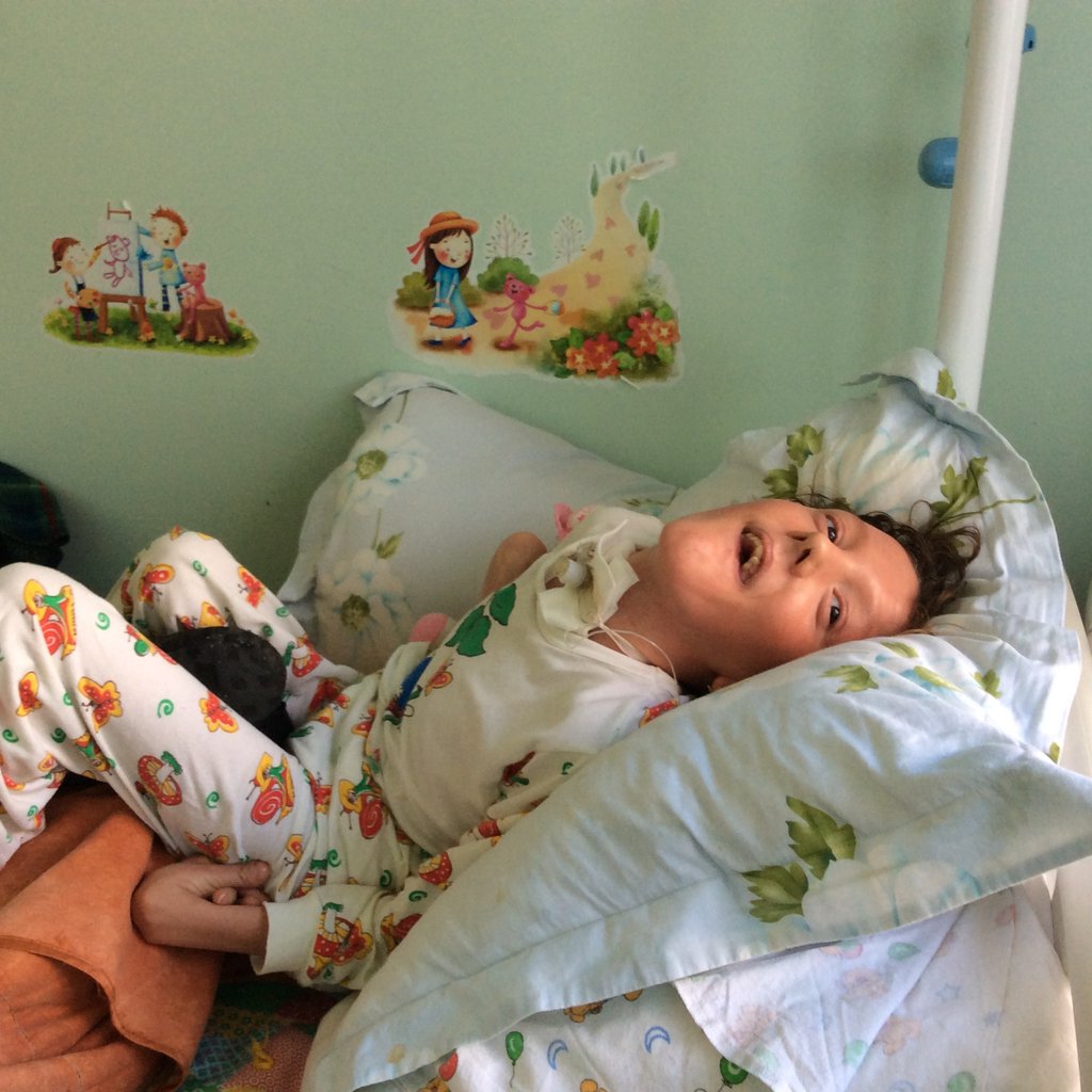 Marina, neurologic long term outcome of drowning