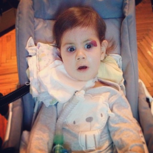 Emmy, 15 months, Werdnig-Hoffmann Disease