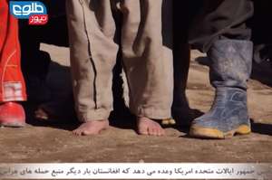 Need of basic supplies