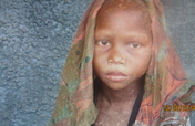 BUILD A MEDICAL CENTER FOR 33000 PEOPLE AT KALO