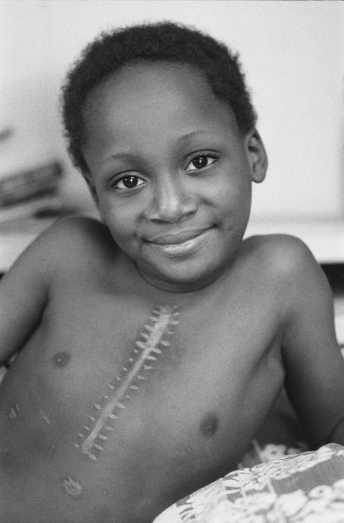 Children's Heart