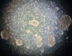 NB-Ebc1, several tumor organoids at 10x