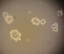 NB-SD, small tumor spheres at 20X magnification