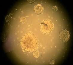 NB-SD, tumor organoids at 20X after 10 days