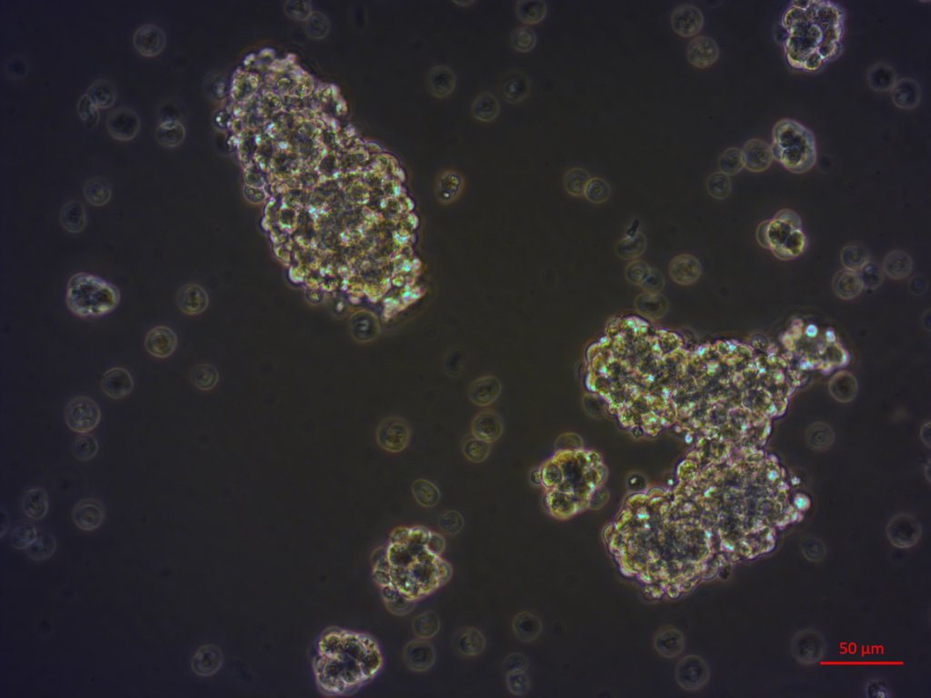 PDOs, NB model with DNA repair deficiency