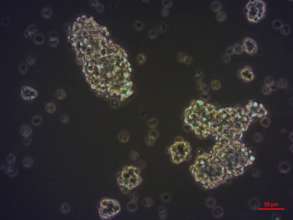 PDOs, NB model with DNA repair deficiency