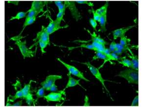 Immunofluorescent Staining of adherent NBL cells