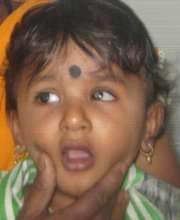 11 months male baby with both eyes ROP