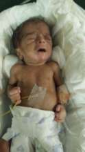 29 weeks old female baby treated for ROP
