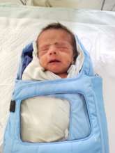 2 weeks male baby treated for ROP