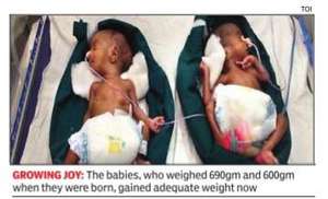 Smallest twins to survive in a non metro hospital