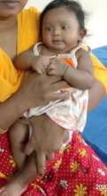 3 MONTHS OLD BABY OPERATED WITH VITRECTOMY
