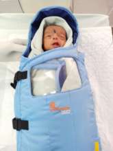 3 weeks female baby treated for ROP