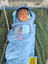6 weeks female baby treated with laser