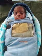 7 months male baby treated for ROP