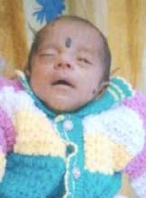 Baby of Kanaka Twin 2