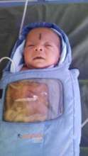 9 weeks old female baby treated for ROP