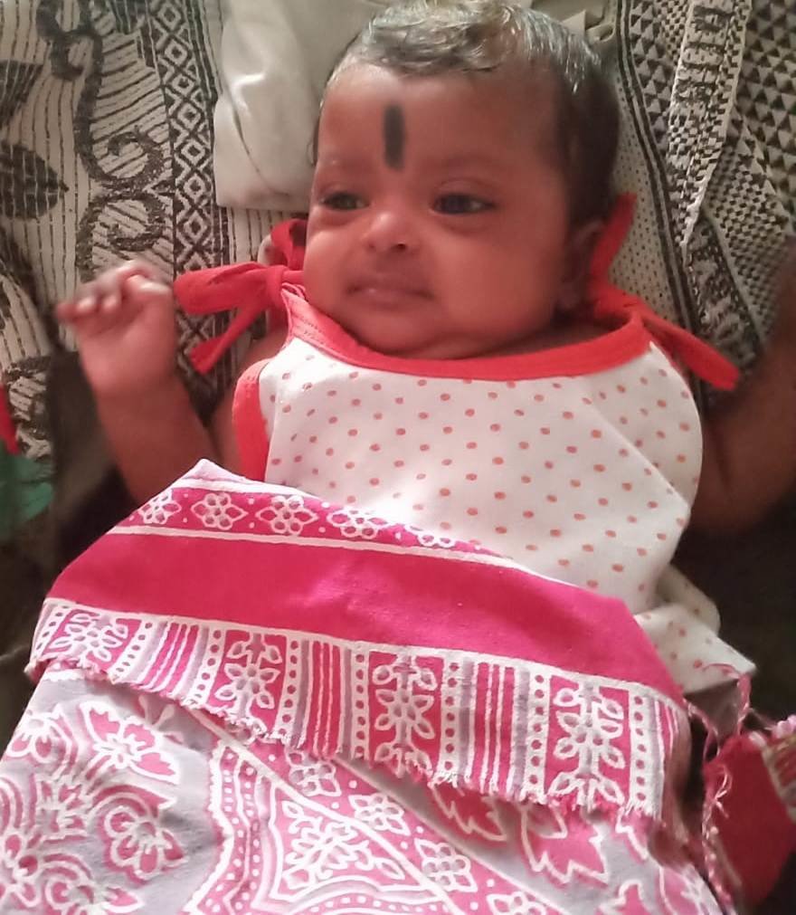 5 weeks female baby treated for APROP