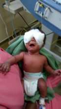 4.5 MONTHS OLD MALE BABY OPERATED FOR ROP