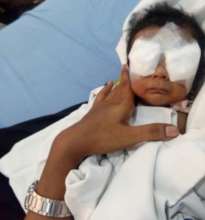 Baby of Pavithra post surgery