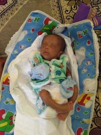 baby treated for preretinal haemorrhage