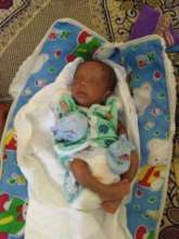 baby treated for preretinal haemorrhage