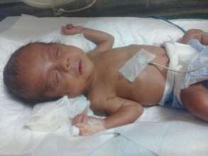 Baby of Shaheen treated for ROP stage 2