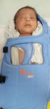 baby treated for APROP
