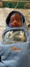 baby treated for APROP