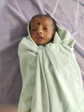baby treated with laser therapy