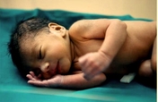 Eye Screening for Premature Babies