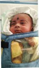 4 weeks old baby treated for ROP