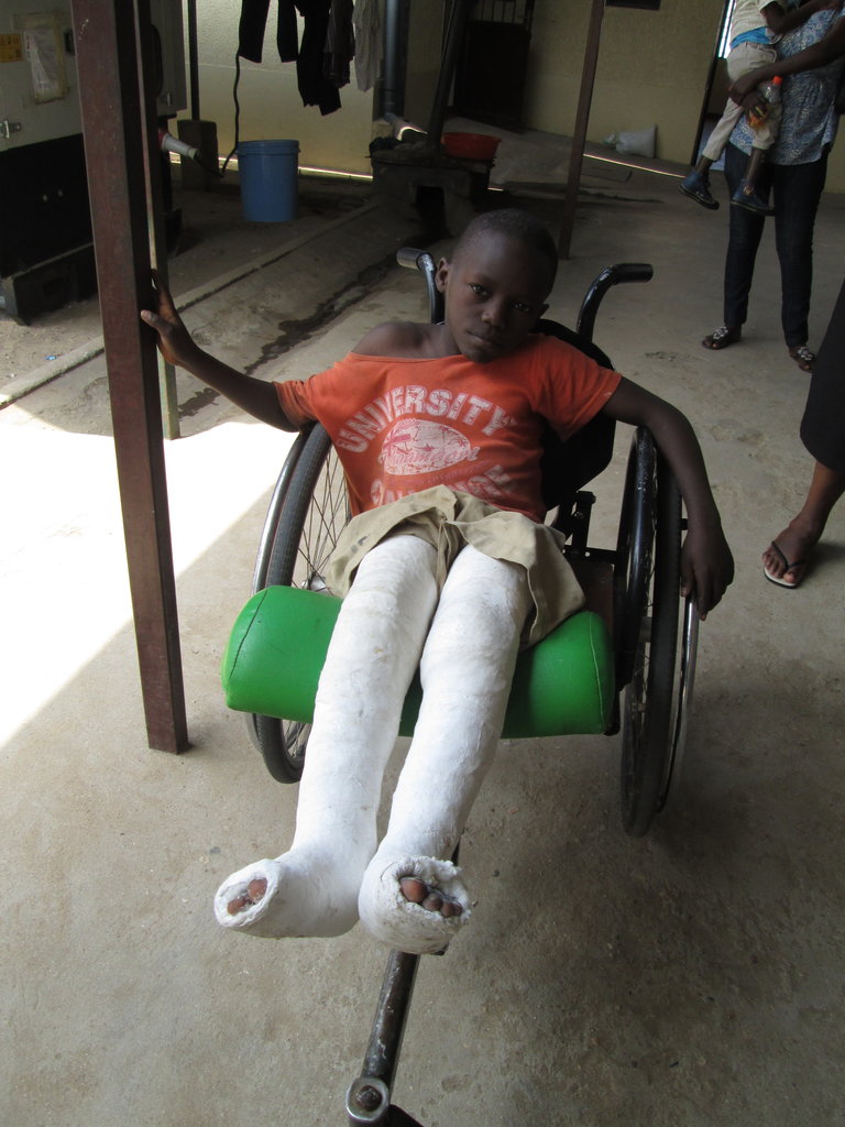 Rehabilitate 70  children handicap in Burundi