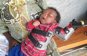 Rehabilitate 70  children handicap in Burundi