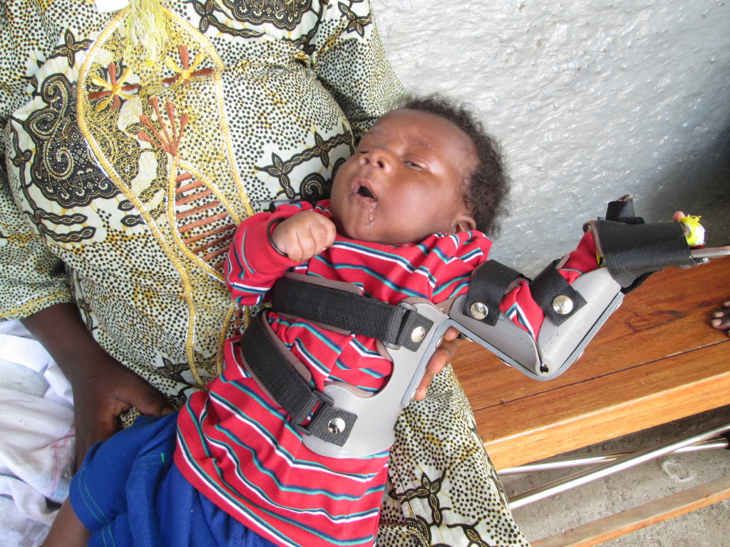 Rehabilitate 70  children handicap in Burundi