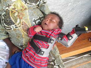 Rehabilitate 70  children handicap in Burundi