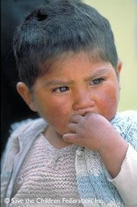 Helping Children Survive to 5 in Bolivia