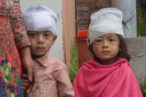 Children with cotton bandages