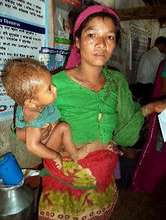 A mother with her malnourished child