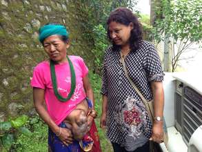 Domar received emergency surgery for this hernia