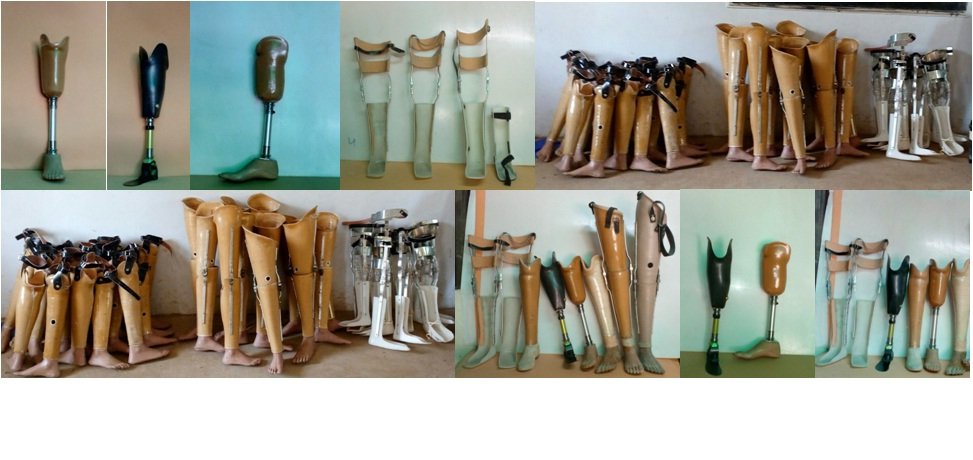 To provide 250 Free Artificial Limbs to Amputees