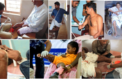 To provide 250 Free Artificial Limbs to Amputees