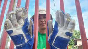 Some serious quills hiding under the hair...