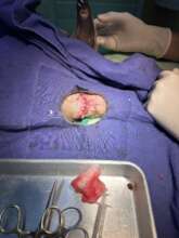 On the operating table...stitched up again...